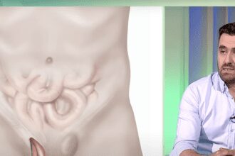 Speranta TV | Sănătate cu prioritate - Hernia inghinală: Cauze, simptome și opțiuni de tratament - Invitat: Bogdan Șerban, medic primar chirurgie generală