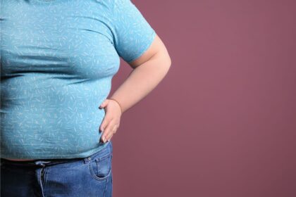 Speranta TV | Sănătate cu Prioritate: Lipedemul - Boala Dureroasă Confundată cu Obezitatea | Ada Chivu, fizioterapeut